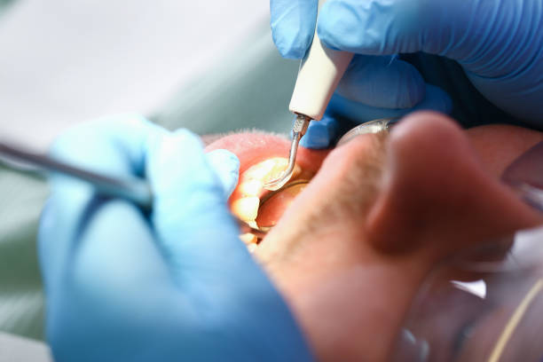 Best Broken or Cracked Tooth Emergency Dentist in Signal Mountain, TN